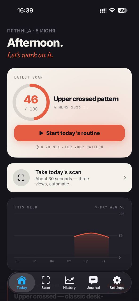 Stoop Today screen showing posture score and pattern